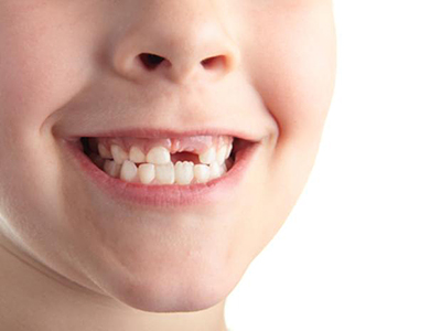 Лечение зубов всеволожск цены