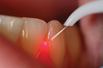 Лечение зубов в всеволожске
