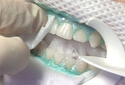 Лечение зубов всеволожск цены thumbnail