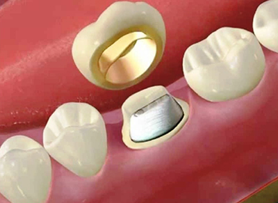 Лечение зубов всеволожск цены