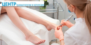 Медицинский педикюр в "Центре травматологии и ортопедии": удаление натоптышей, трещин, мозолей, лечение вросшего ногтя и не только со скидкой до 50%